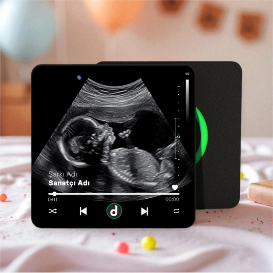 Ultrason Fotoğraflı DizzyMagnet Kişiye Özel Ses ve Müzikli Magnet V4.0