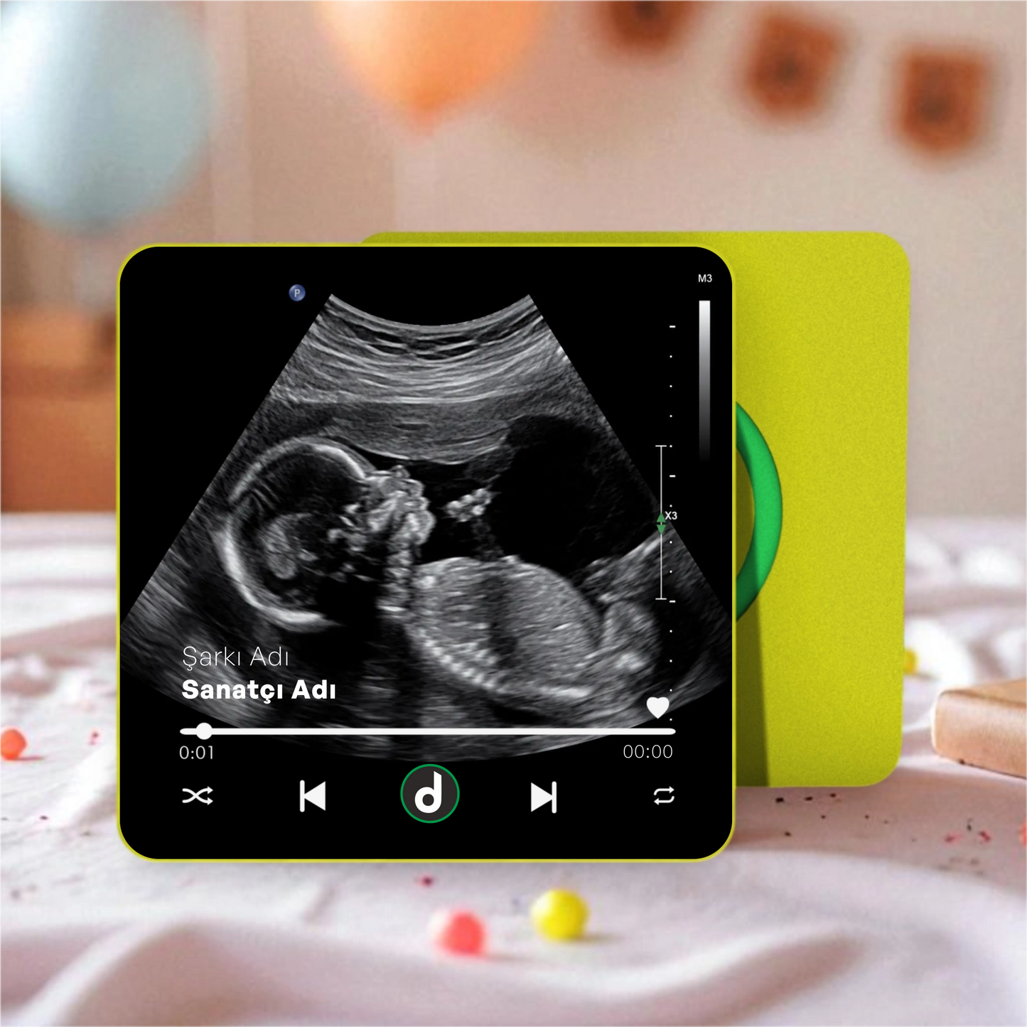 Ultrason Fotoğraflı DizzyMagnet Kişiye Özel Ses ve Müzikli Magnet V4.0