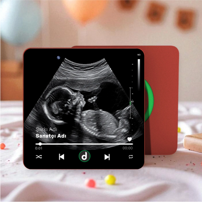 Ultrason Fotoğraflı DizzyMagnet Kişiye Özel Ses ve Müzikli Magnet V4.0