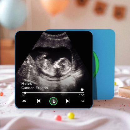 Ultrason Fotoğraflı BeatsMagnet Kişiye Özel Ses ve Müzikli Magnet V4.0