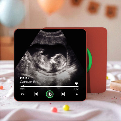 Ultrason Fotoğraflı BeatsMagnet Kişiye Özel Ses ve Müzikli Magnet V4.0