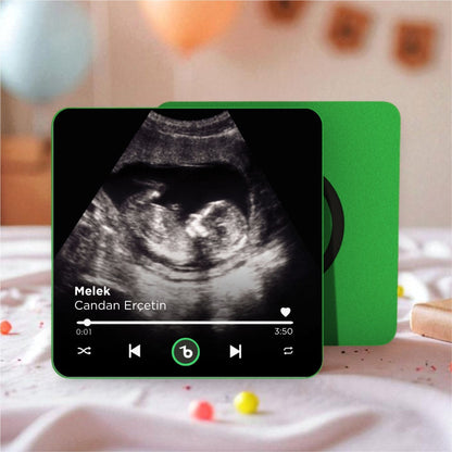 Ultrason Fotoğraflı BeatsMagnet Kişiye Özel Ses ve Müzikli Magnet V4.0
