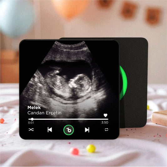 Ultrason Fotoğraflı BeatsMagnet Kişiye Özel Ses ve Müzikli Magnet V4.0